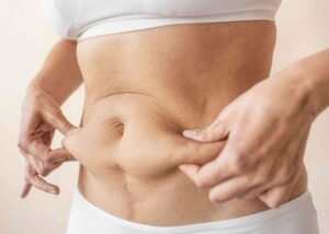 diet for tummy tuck