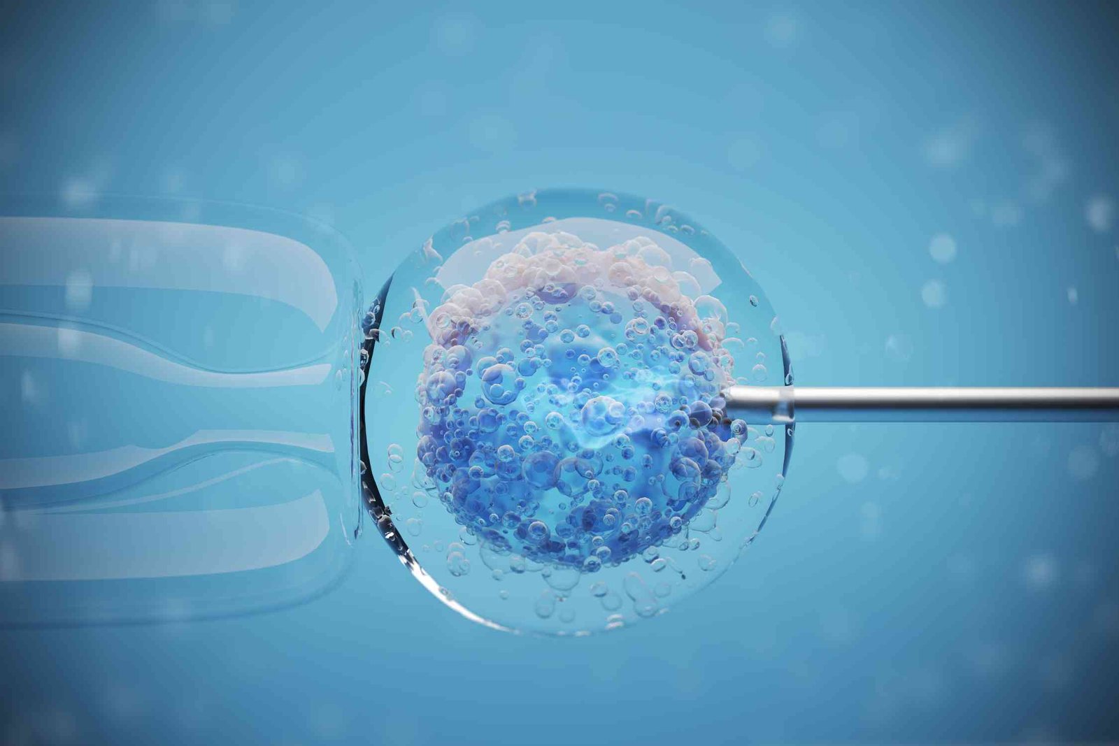 Steps in IVF Treatment