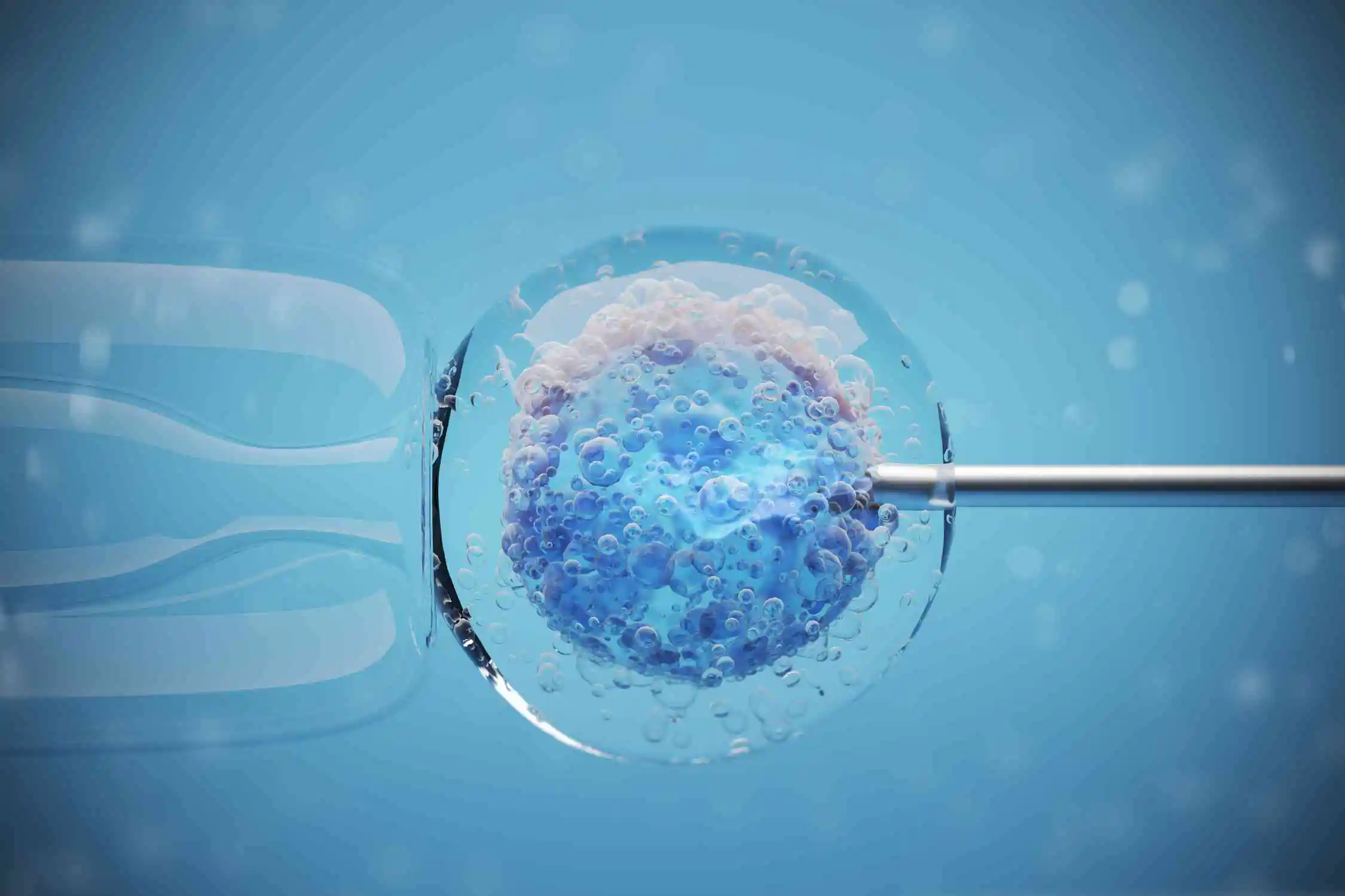 Steps in IVF Treatment