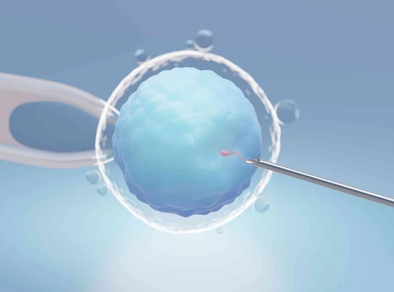 in vitro fertilization