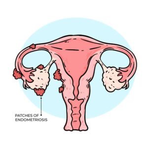 fallopian tube inflamed