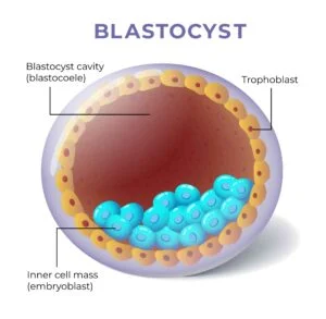 blastocyst