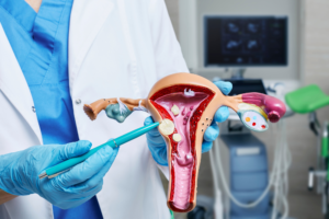 common gynaecological cancers 